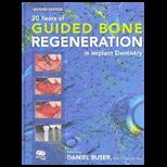 Guided Bone Regeneration in Implant Dentist.