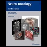 Neuro Oncology Essentials