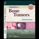 Dahlins Bone Tumors General Aspects and Data on 10,165 Cases