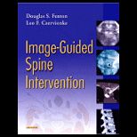 Image Guided Spine Intervention