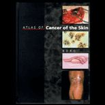 Atlas of Cancer of the Skin