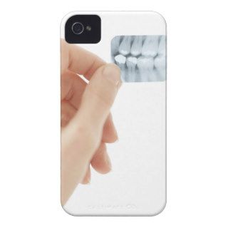 MODEL RELEASED. Dental X ray. iPhone 4 Covers