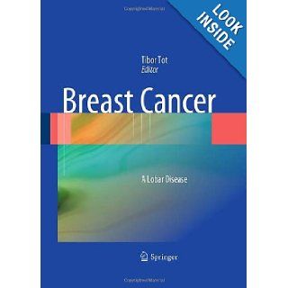 Breast Cancer A Lobar Disease Tibor Tot 9781849963138 Books
