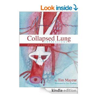 Collapsed Lung ExpressionsSkipping on a Lifeline eBook Tim Mayeur Kindle Store