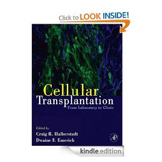 Cellular Transplantation From Laboratory to Clinic eBook Craig Halberstadt, Dwaine F. Emerich Kindle Store