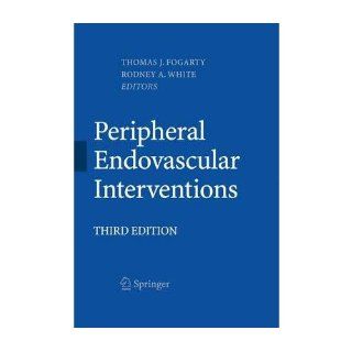 [ Peripheral Endovascular Interventions (2010) [ PERIPHERAL ENDOVASCULAR INTERVENTIONS (2010) ] By Fogarty, Thomas J ( Author )Jun 09 2010 Hardcover Thomas J Fogarty Books