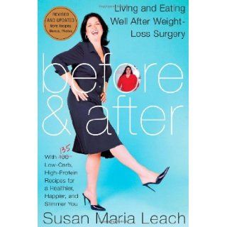 Before & After, Revised Edition Living and Eating Well After Weight Loss Surgery [Paperback] [2007] (Author) Susan Maria Leach Books
