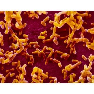 Yersinia pestis (plague) bacteria   4.5 by sciencephotos