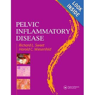 Pelvic Inflammatory Disease Richard L. Sweet, Harold C. Wiesenfeld 9781842142899 Books
