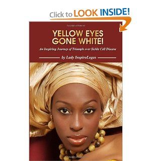 Yellow Eyes Gone White Lady InspiroLogos 9781434930309 Books