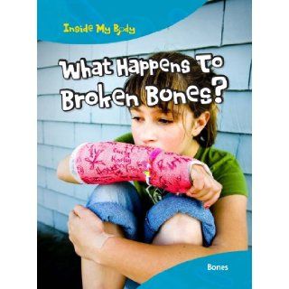 What Happens to Broken Bones? (Inside My Body) Carol Ballard 9781410940117 Books