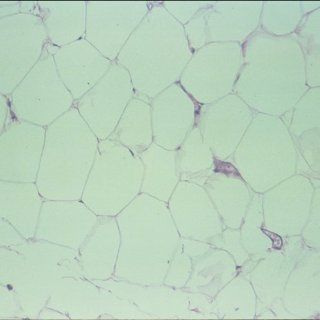 Human Adipose Tissue, sec., 7 µm, H&E Microscope Slide