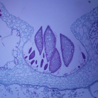 Anthoceros Mature Sporophyte, l.s., 12 µm Microscope Slide