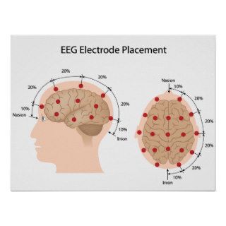 EEG electrode placement diagram Poster