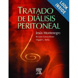 Tratado de Dilisis Peritoneal Jesus Montenegro Martnez 9788480863940 Books