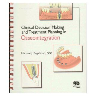 Clinical Decision Making and Treatment Planning in Osseointegration (9780867153187) Michael Engelman Books
