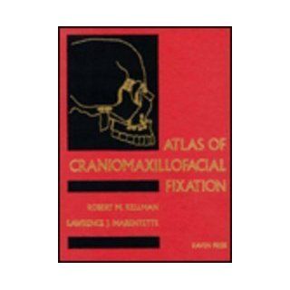 Atlas of Craniomaxillofacial Fixation (9780781700160) Robert M. Kellman, Lawrence J. Marentette Books