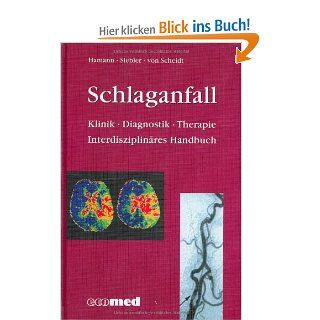 Schlaganfall Klinik Diagnostik Therapie Interdisziplinres Handbuch Gerhard Hamann, Mario Siebler, Wolfgang Scheidt Bücher