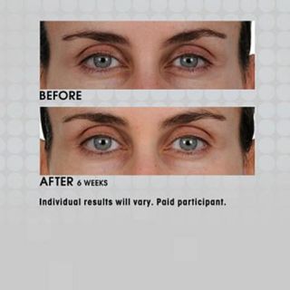 PREVAGE® .5 fl. oz. Anti aging Eye Serum   7690540